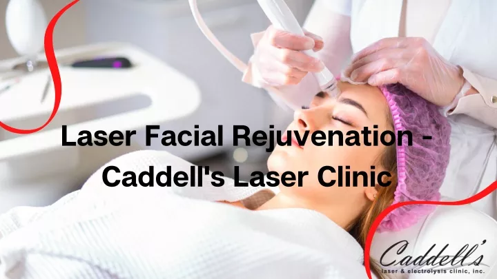 laser facial rejuvenation caddell s laser clinic