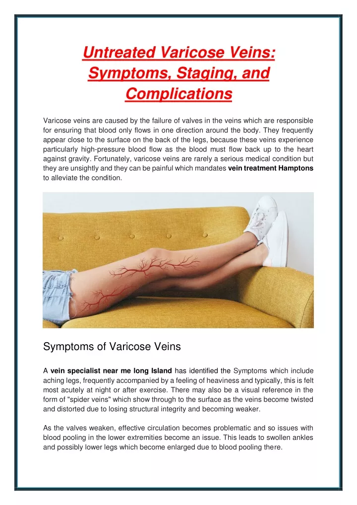 untreated varicose veins symptoms staging