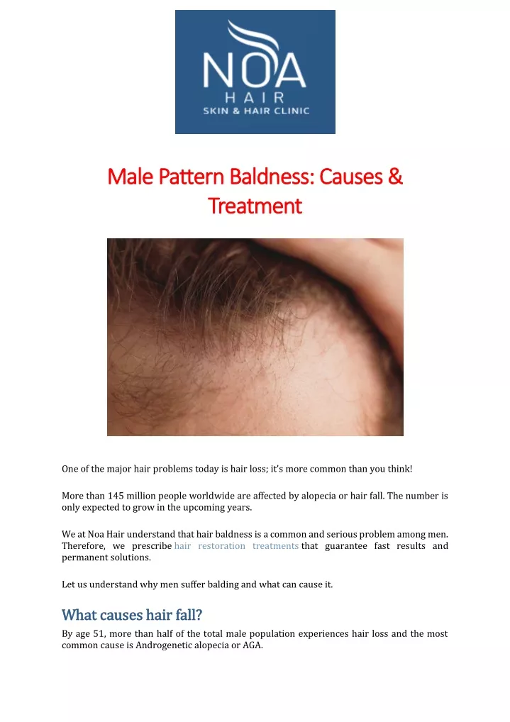 male pattern baldness causes male pattern