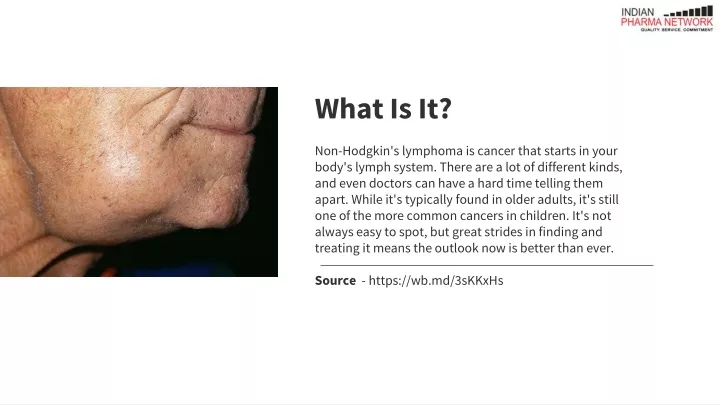 what is it non hodgkin s lymphoma is cancer that