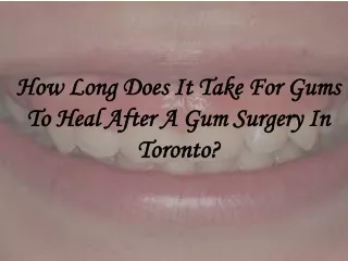 How Long Does It Take For Gums To Heal After A Gum Surgery In Toronto