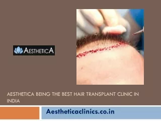 Aesthetica being the Best Hair Transplant Clinic in India