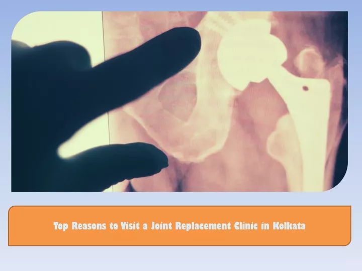 top reasons to visit a joint replacement clinic