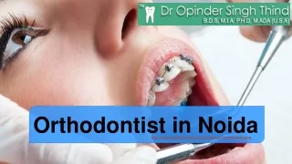 Orthodontist in Noida