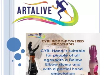 motorica-prosthetics-upper-limb-cybi-hand - Artalive