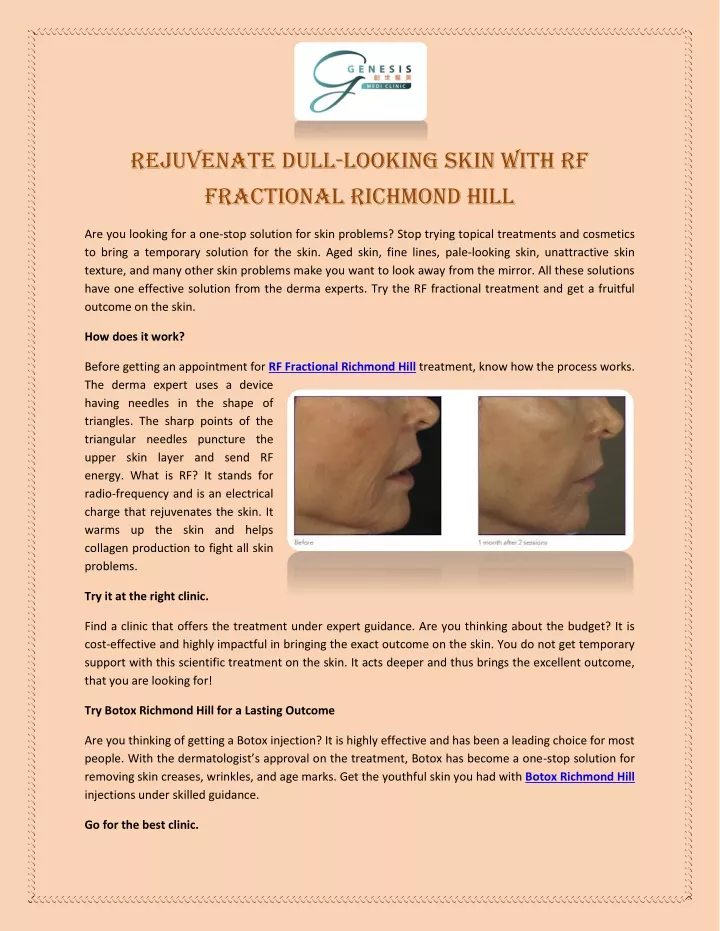 rejuvenate dull looking skin with rf fractional