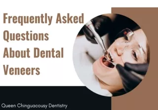 Frequently Asked Questions About Dental Veneers