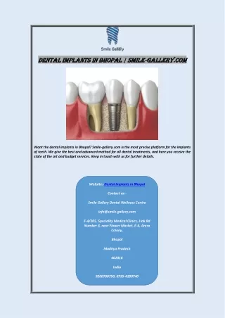 dental implants in bhopal smile dental implants