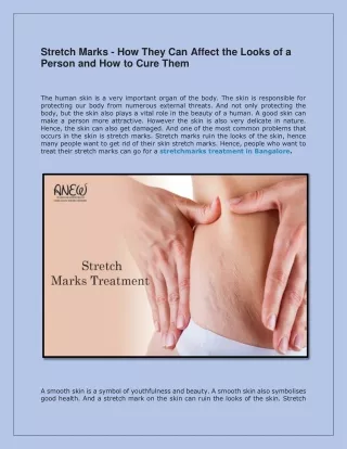 stretch marks how they can affect the looks