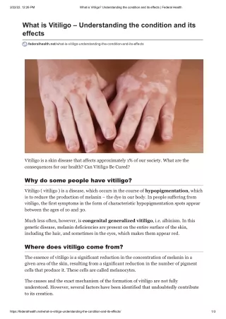 What is Vitiligo_ Understanding the condition and its effects