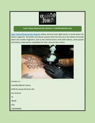 Laser Tattoo Removal San Antonio | Colorblindminds.com