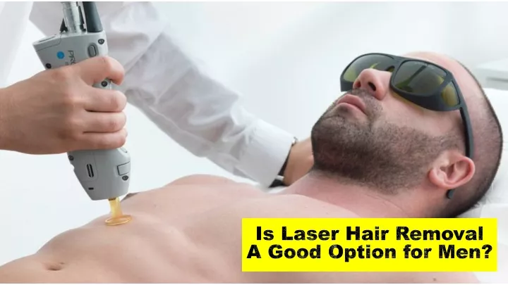 is laser hair removal a good option for men