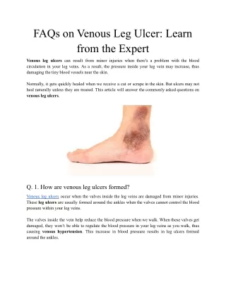 faqs on venous leg ulcer learn from the expert