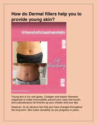 how do dermal fillers help you to provide young