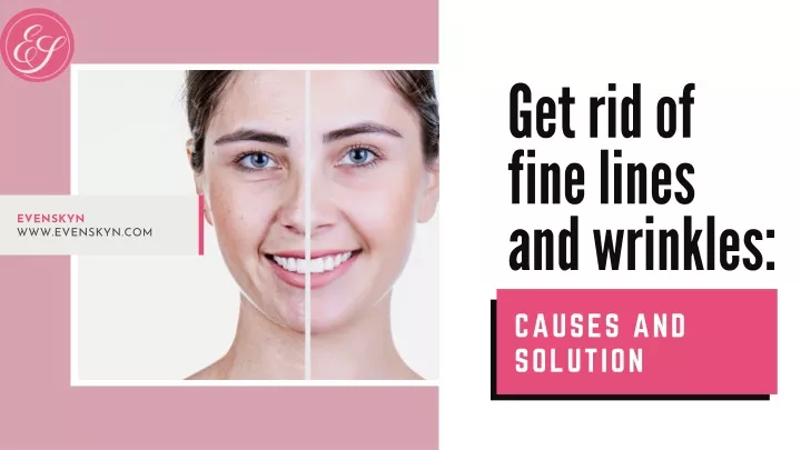 get rid of fine lines and wrinkles