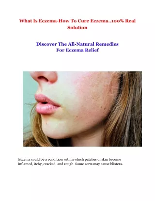 what is eczema how to cure eczema 100 real