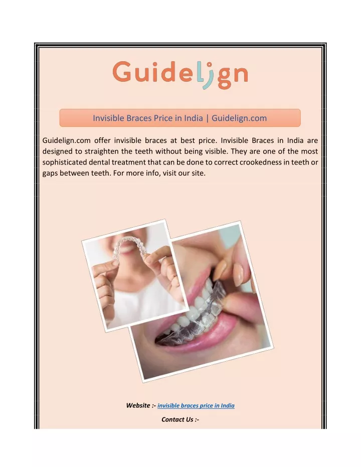 invisible braces price in india guidelign com