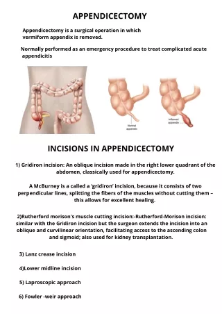 appendicectomy