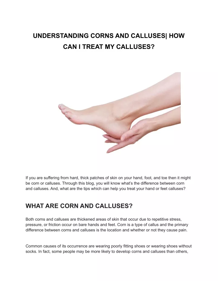 understanding corns and calluses how