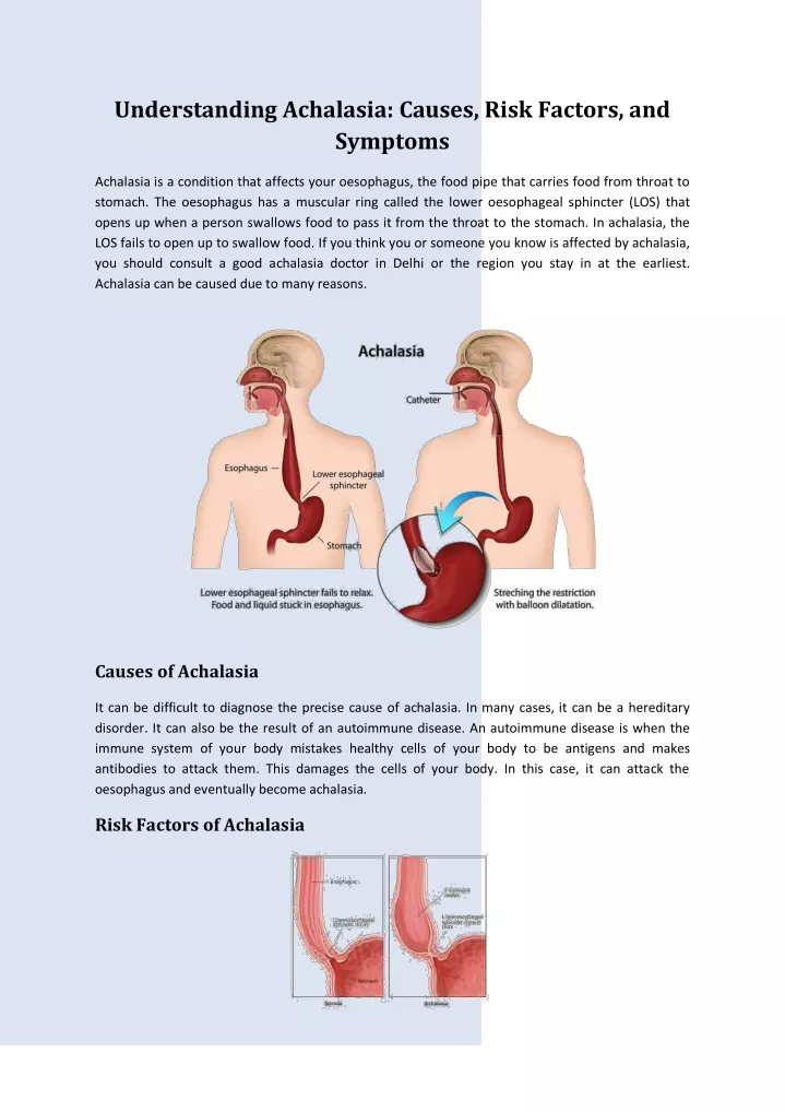 understanding achalasia causes risk factors