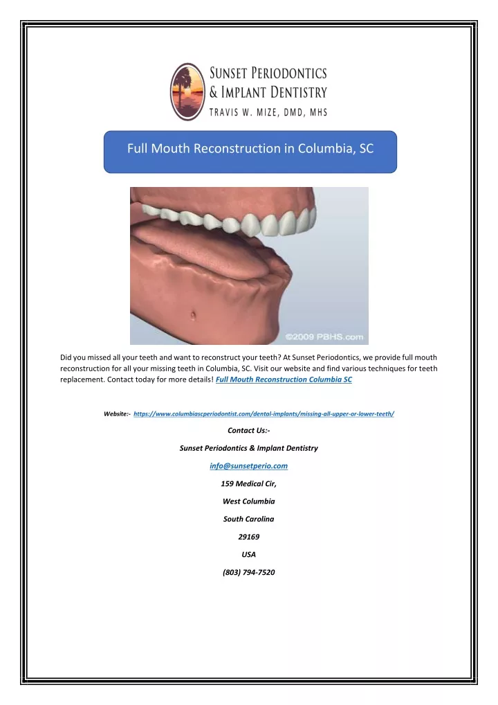 full mouth reconstruction in columbia sc