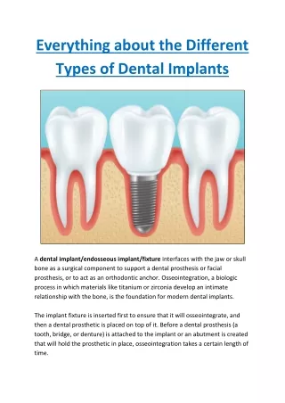 Everything about the Different Types of Dental Implants