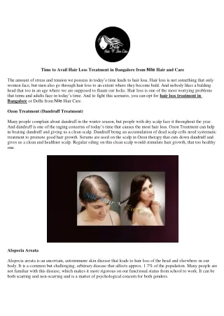 Time to Avail Hair Loss Treatment in Bangalore from Nile Hair and Care
