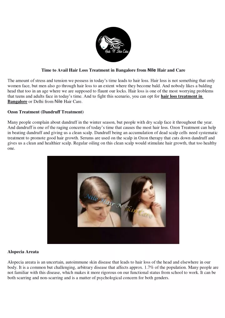 time to avail hair loss treatment in bangalore
