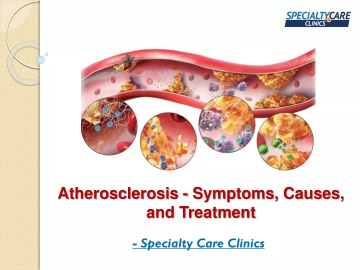atherosclerosis symptoms causes and treatment