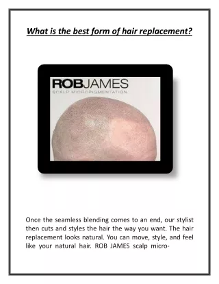 what is the best form of hair replacement
