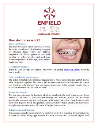 How do braces work?