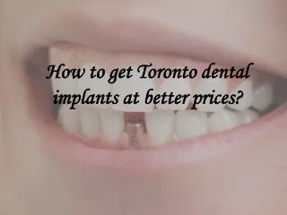 How to get Toronto dental implants at better prices