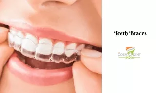 teeth braces