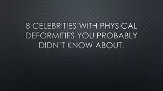 8 Celebrities With Physical Deformities You Probably Didn’t Know About!