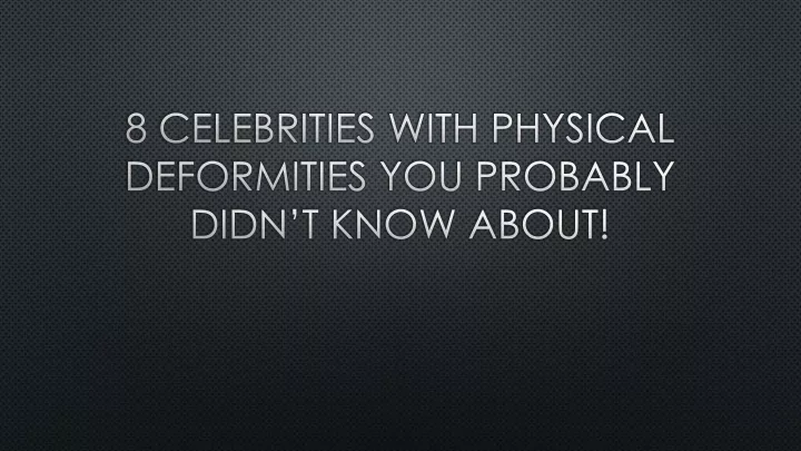 8 celebrities with physical deformities you probably didn t know about