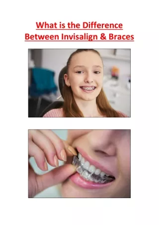 What is the Difference Between Invisalign & Braces