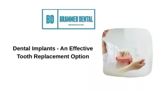 Dental Implants - An Effective Tooth Replacement Option
