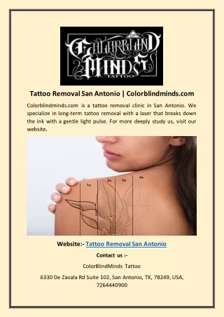 Tattoo Removal San Antonio | Colorblindminds.com