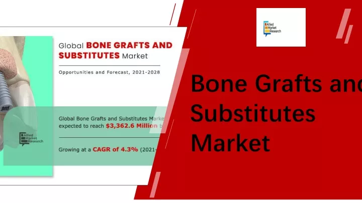 bone grafts and substitutes market