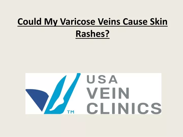 could my varicose veins cause skin rashes