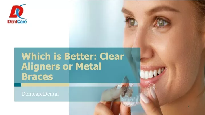 which is better clear aligners or metal braces