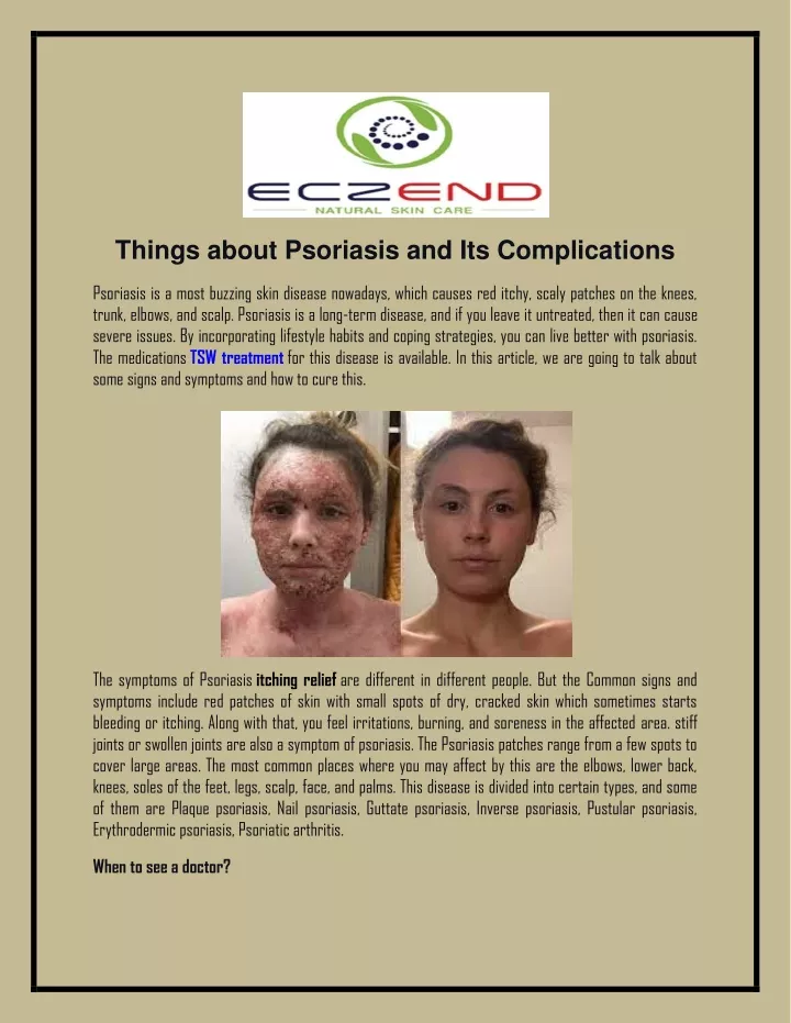 things about psoriasis and its complications