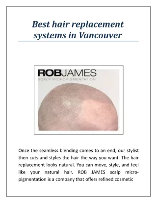 best hair replacement systems in vancouver