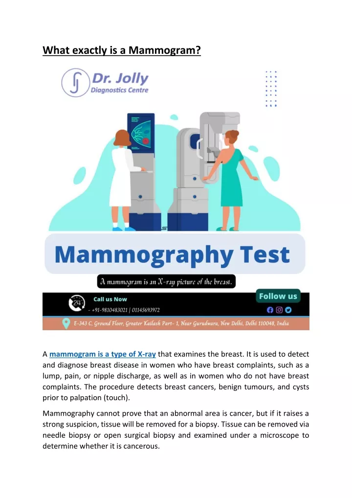 what exactly is a mammogram
