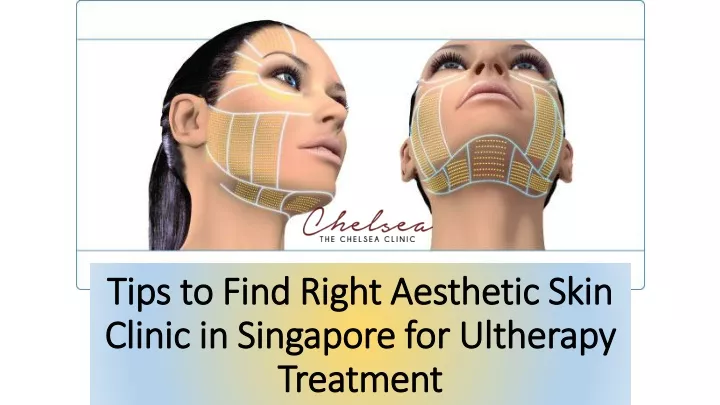 tips to find right aesthetic skin clinic in singapore for ultherapy treatment