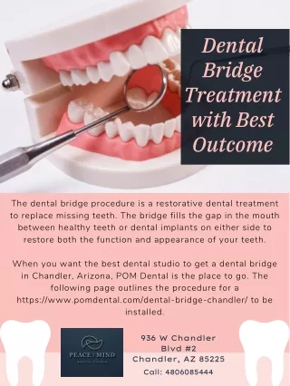 Dental Bridge Treatment with Best Outcome