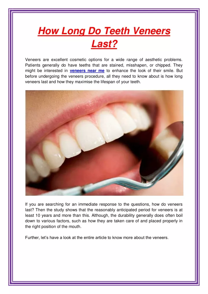 how long do teeth veneers last