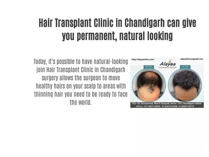 hair transplant clinic in chandigarh can give