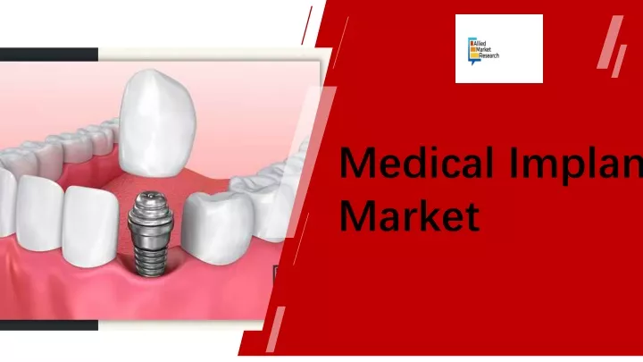 medical implant market