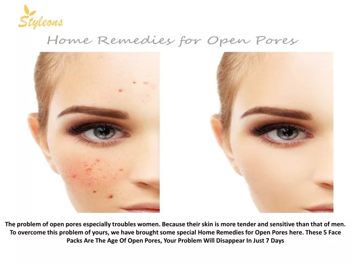 the problem of open pores especially troubles